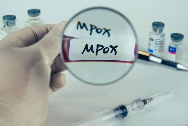 Perú emite una alerta epidemiológica sobre un nuevo linaje de Mpox - Mundo - ABC Color