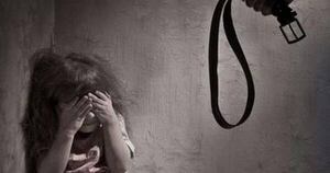 La Nación / Niño tiene rastros de agresión física por aparentes cintarazos del padrastro