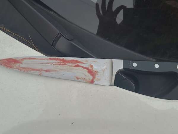Desconocido habría muerto tras caer sobre un cuchillo con el que atacó a guardia - Policiales - ABC Color