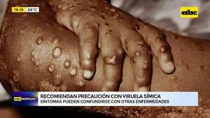 Recomiendan precaución con viruela símica: síntomas pueden confundirse con otras enfermedades - ABC Noticias - ABC Color