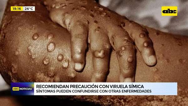 Recomiendan precaución con viruela símica: síntomas pueden confundirse con otras enfermedades - ABC Noticias - ABC Color