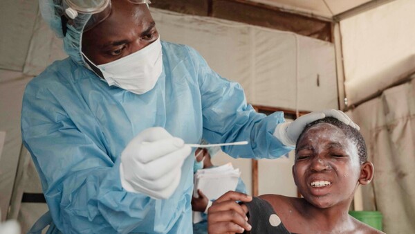 Conozca las claves de la renovada crisis sanitaria de mpox en África