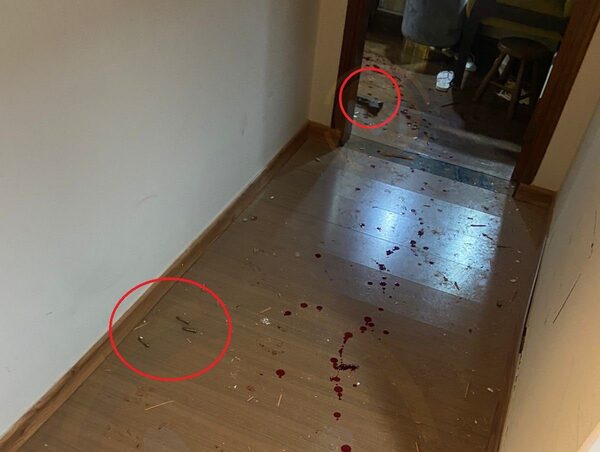 "Se destruyó totalmente el corazón”: Lalo Gomes murió de manera instantánea, según análisis forense · Radio Monumental 1080 AM