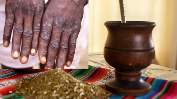 Recomiendan no compartir mate ni tereré por protección contra la viruela del mono