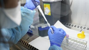 Argentina aísla a un buque de Liberia al detectar síntomas de la viruela del mono en un tripulante