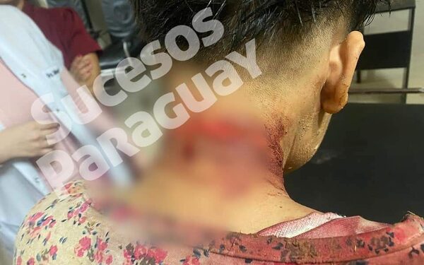 Menor herido con cuchillo en presunto intento de feminicidio