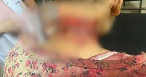 Diario HOY | Adolescente de 15 años fue acuchillada por otro joven en Tobatí