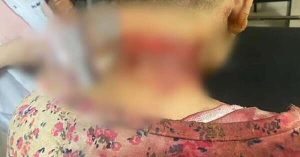 Diario HOY | Adolescente de 15 años fue acuchillada por otro joven en Tobatí