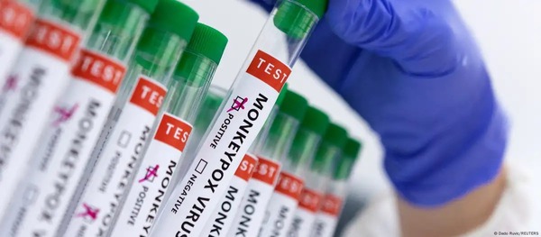 Argentina descarta caso de mpox en buque carguero - ADN Digital