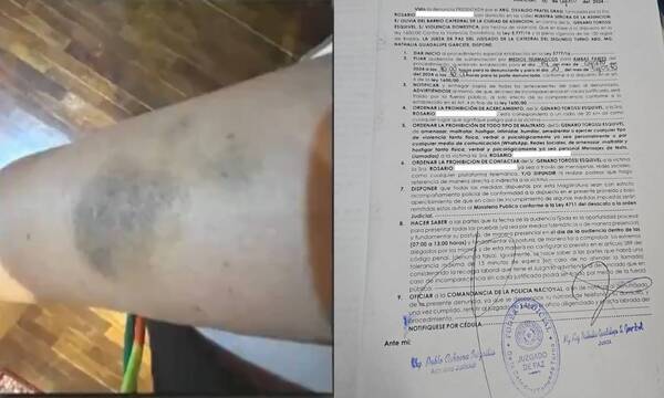 Mujer teme por su vida: denunció a quien era su pareja por maltrato y por apropiación millonaria