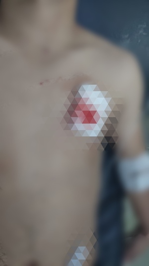 Violencia Familiar en Belén: Hombre Herido con Arma Blanca por su Pareja