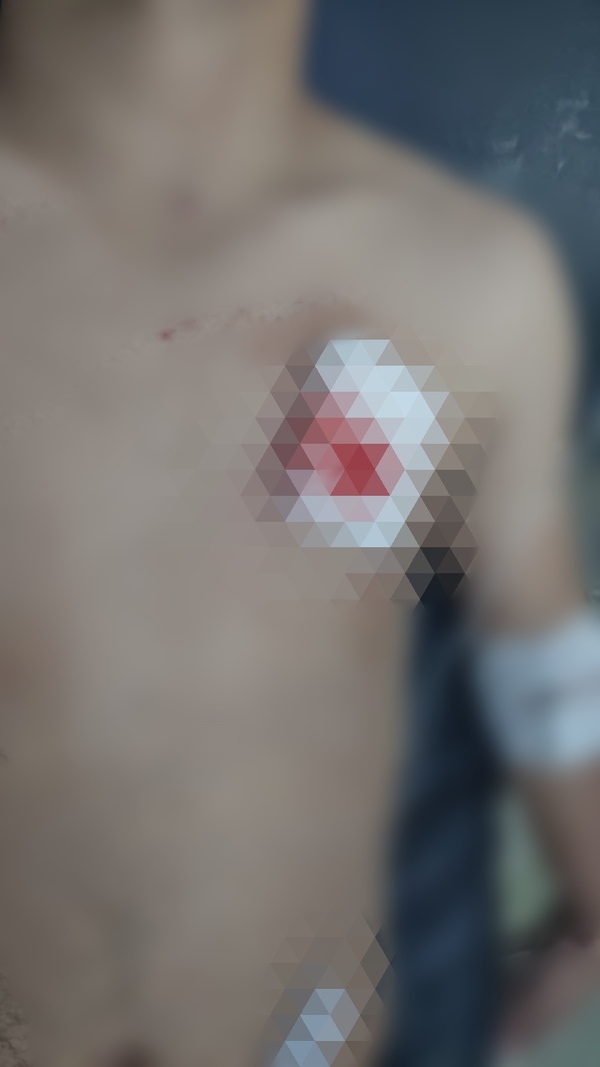 Violencia Familiar en Belén: Hombre Herido con Arma Blanca por su Pareja