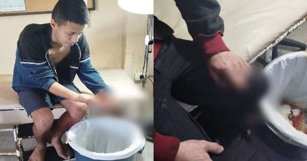 Diario HOY | ¿Gresca o castigo?: reos del CERESO fueron al hospital tras sufrir graves heridas en los dedos