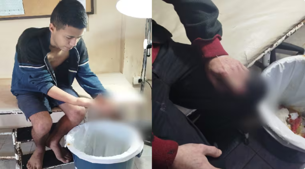Presos del Cereso fueron atendidos en Hospital de Encarnación porque perdieron los dedos