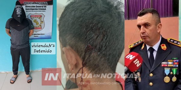 DETUVIERON A SUJETO QUE HABRÍA DISPARADO A UN HOMBRE EN LA CABEZA EN CAMBYRETÁ - Itapúa Noticias