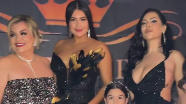 [VIDEO] ¡Laurys Dyva posó con un vestido inspirado en su gallina Hortensia!