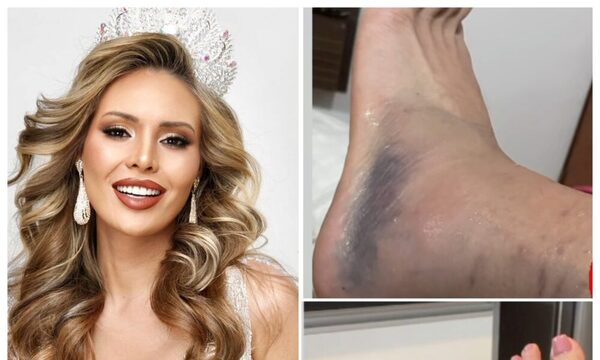 Miss Cosmo tuvo un accidente y no podrá representar a Paraguay