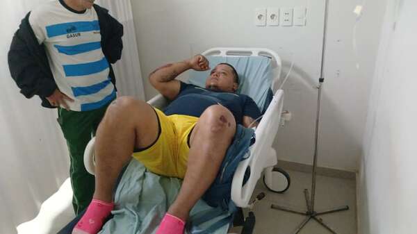 Motociclista embestido por camión en Pedrozo narra lo que vivió: “Vi la imagen de mi sobrinito” - Nacionales - ABC Color