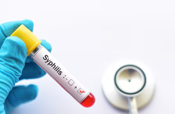 Aumentan casos de sífilis en el país