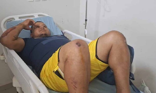 Motociclista sobreviviente del accidente en Pedrozo vuelve internarse – Prensa 5