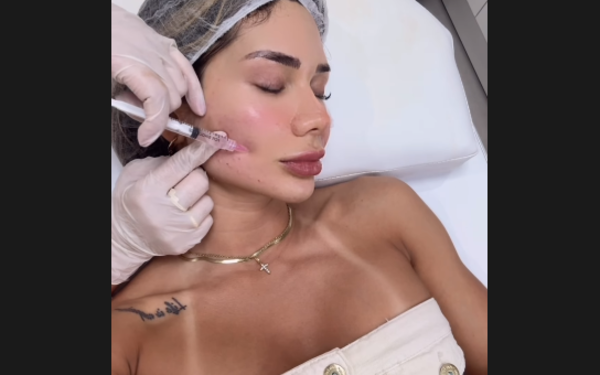 ¡Mirá lo que se inyecta Judith Gamarra en la cara para ser linda!
