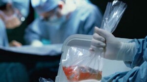 Donantes de vida: cómo un solo gesto puede salvar hasta ocho personas