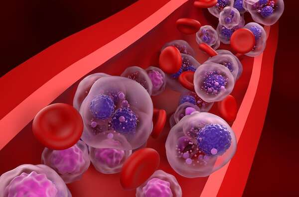 México alerta de alta incidencia de casos de mieloma múltiple - Ciencia - ABC Color