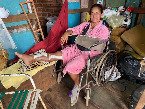 Se accidentó hace 3 meses, está imposibilitada para trabajar y vive mediante la caridad de los vecinos