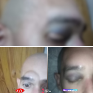 DENUNCIA DE MALTRATO LABORAL Y RECLAMO POR DESPIDO INJUSTIFICADO EN ENCARNACIÓN - TVS