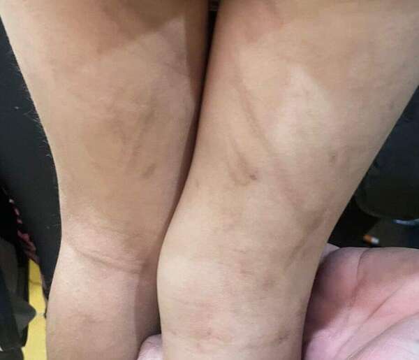 Villeta: padre y madrastra habrían golpeado con brutalidad a niño de tres años - Nacionales - ABC Color