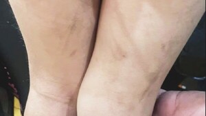 Padre y madrastra presos por castigar brutalmente a niño de 3 años
