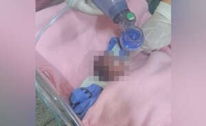 Familia de Villarrica pide ayuda para salvar a su bebé prematura