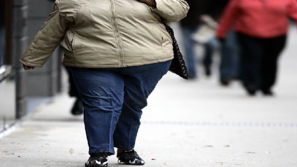 Obesidad en Paraguay y el mundo: una crisis de salud pública