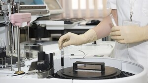 Identifican cambios tempranos en el cerebro que podrían anticipar el riesgo de alzheimer