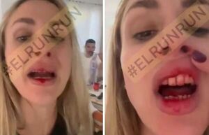“Me está cagando a palos”: se filtró un nuevo video de la pareja de Néstor Ortigoza con sangre en la boca
