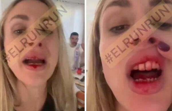 “Me está cagando a palos”: se filtró un nuevo video de la pareja de Néstor Ortigoza con sangre en la boca