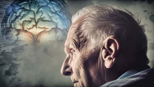 El Alzheimer, la principal causa de demencia a nivel mundial » San Lorenzo PY