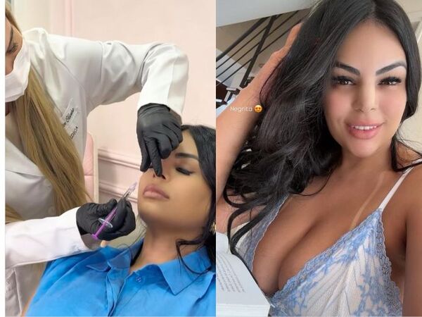 Cuerona opinó sobre las cirugías: “Los retoques ayudan a aumentar la confianza”