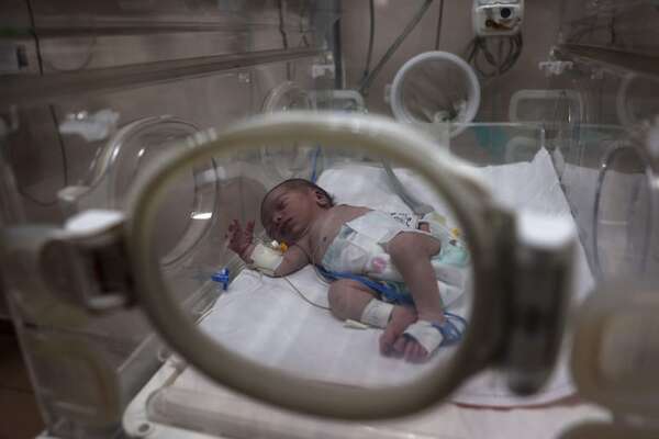 Los bebés nacidos en la pandemia no tienen más riesgo de tener autismo - Mundo - ABC Color