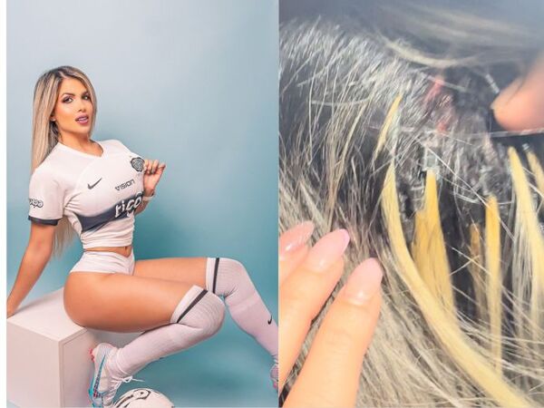 Le reventaron la cabeza a la madrinita del Olimpia: “Fueron hinchas aurinegros”, he’i