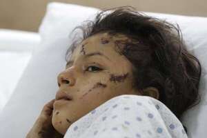 Suben a 558 los muertos por bombardeos israelíes contra Líbano, entre ellos 50 niños - Mundo - ABC Color