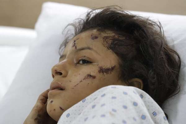Suben a 558 los muertos por bombardeos israelíes contra Líbano, entre ellos 50 niños - Mundo - ABC Color