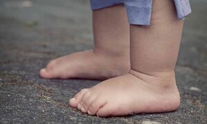 Institución pública de Brasil lamenta muerte de niño paraguayo de 1 año – Prensa 5