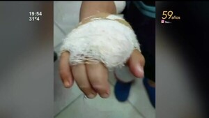 Un niño fue atacado por un perro en Ypané - SNT