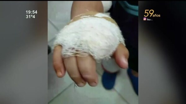 Un niño fue atacado por un perro en Ypané - SNT