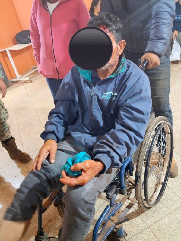 Motociclista impacta contra peatón con orden de captura en Horqueta