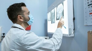 Un estudio confirmó que un caso grave de covid-19 envejece el cerebro 20 años