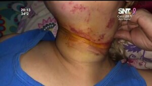 Una mujer casi fue degollada por un cable suelto - SNT