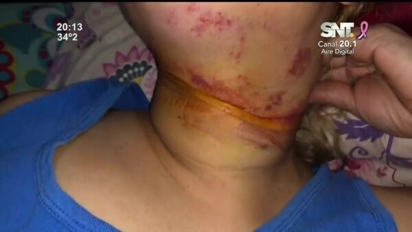 Una mujer casi fue degollada por un cable suelto - SNT