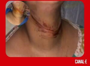 CABLE SUELTO CASI DEGOLLA A UNA MUJER